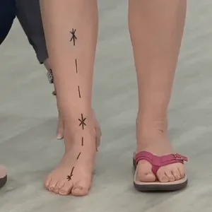 Orthopedic flip-flop sandals