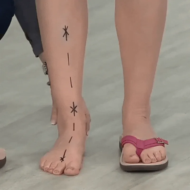 Orthopedic flip-flop sandals